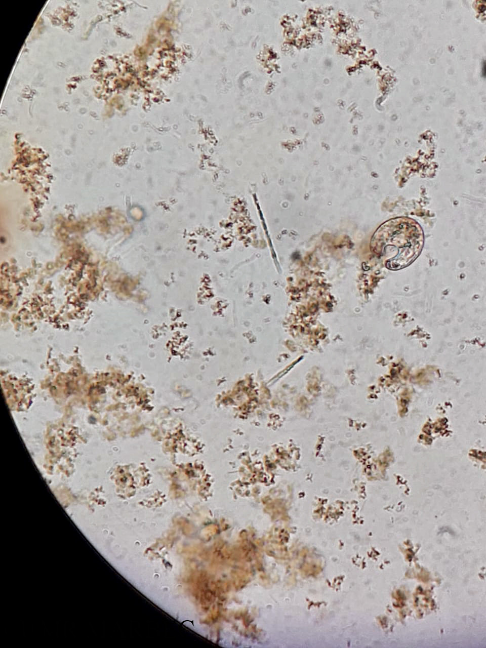 phyto/Brazilian_Amazon_coast/Amazomix_station_6/AMAZOMIX September 2021/Pyrocystis obtusa (Am_st6_R2_DCM_TALVEZ_Pyrocystis)(copy).jpg